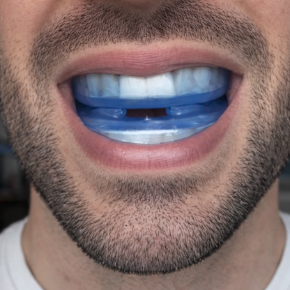 Anti-snarkningsskena som passar alla